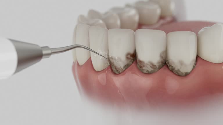 Trusted Invisalign Clear Aligners service in Poydras, LA - Dentist Open Now